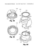 Low-profile surgical access devices with anchoring diagram and image