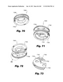 Low-profile surgical access devices with anchoring diagram and image