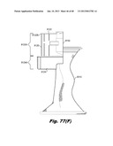 Low-profile surgical access devices with anchoring diagram and image