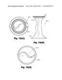 Low-profile surgical access devices with anchoring diagram and image