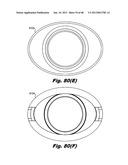 Low-profile surgical access devices with anchoring diagram and image