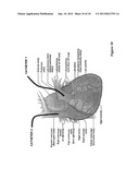 In-Vivo Optical Sensor diagram and image