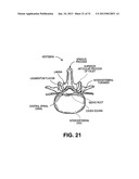 METHOD, SYSTEM AND APPARATUS FOR NEURAL LOCALIZATION diagram and image