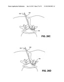 METHOD, SYSTEM AND APPARATUS FOR NEURAL LOCALIZATION diagram and image