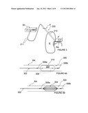 ULTRASOUND APPARATUSES FOR THERMALLY-INDUCED RENAL NEUROMODULATION AND     ASSOCIATED SYSTEMS AND METHODS diagram and image