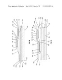 WOUND OR SKIN TREATMENT DEVICES AND METHODS diagram and image