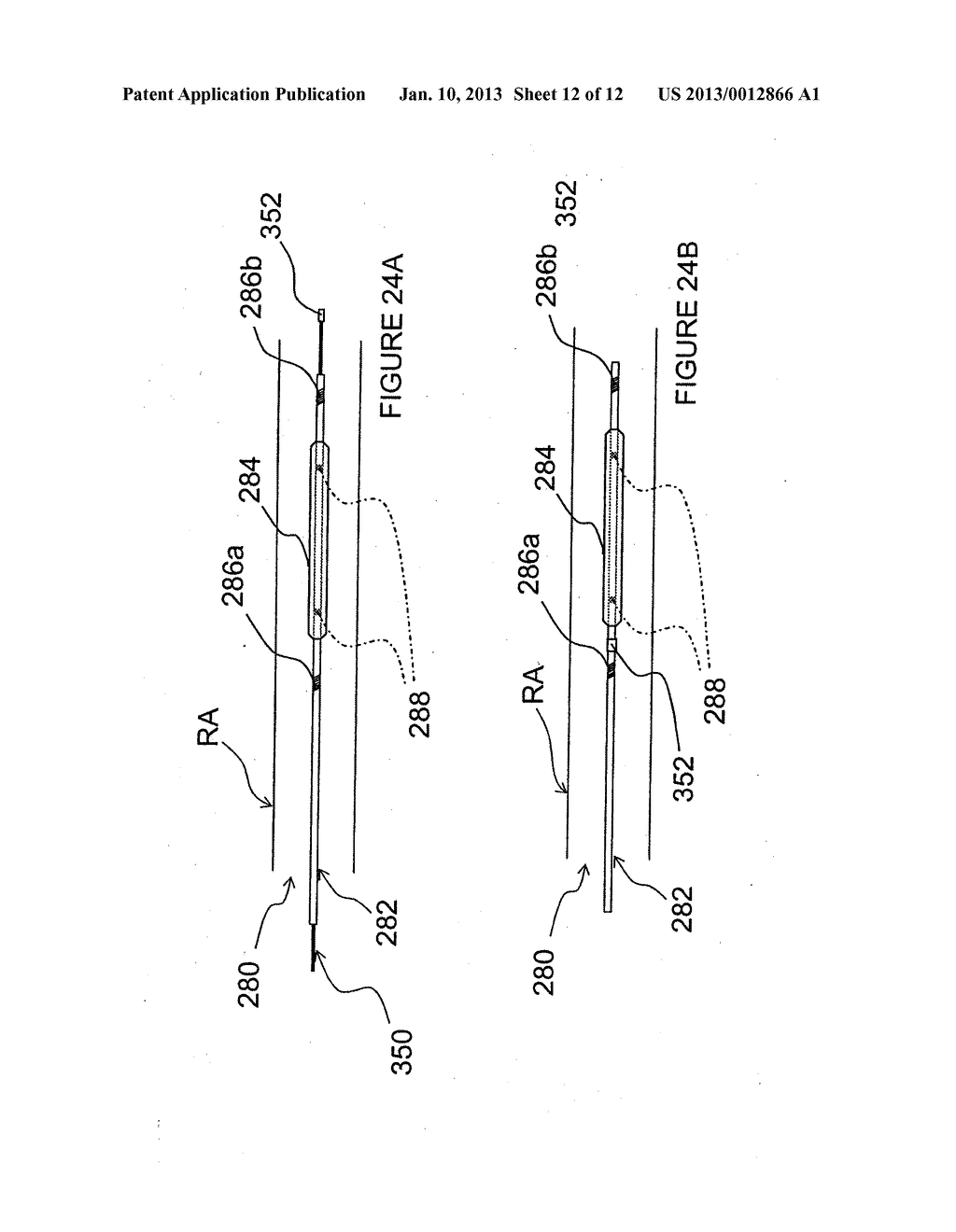 APPARATUSES FOR RENAL NEUROMODULATION AND ASSOCIATED SYSTEMS AND METHODS - diagram, schematic, and image 13