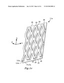 METHOD FOR PRODUCING A WEB OF A LAMINATE MATERIAL FOR RETAINING FAECES AND     METHOD FOR PRODUCING AN ABSORBENT ARTICLE diagram and image