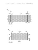 METHOD FOR PRODUCING A WEB OF A LAMINATE MATERIAL FOR RETAINING FAECES AND     METHOD FOR PRODUCING AN ABSORBENT ARTICLE diagram and image