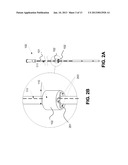 NASO/OROGASTRIC TUBE HAVING ONE OR MORE BACKFLOW BLOCKING ELEMENTS,     BACKFLOW BLOCKING ELEMENTS, AND A METHOD OF USING BACKFLOW BLOCKING     ELEMENTS diagram and image