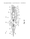 Surgical Tack and Tack Drive Apparatus diagram and image