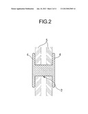 STENT FOR CONNECTING ADJACENT TISSUES OF ORGANS diagram and image