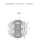 STENT FOR CONNECTING ADJACENT TISSUES OF ORGANS diagram and image