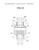 STENT FOR CONNECTING ADJACENT TISSUES OF ORGANS diagram and image