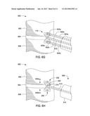 APPARATUS FOR COMPRESSING OR DECOMPRESSING A SPINAL DISC AND METHOD OF USE     THEREOF diagram and image