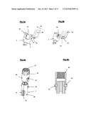 DEVICE AND METHOD FOR SPINAL SURGERY diagram and image