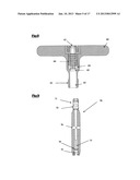 DEVICE AND METHOD FOR SPINAL SURGERY diagram and image