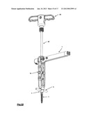 DEVICE AND METHOD FOR SPINAL SURGERY diagram and image