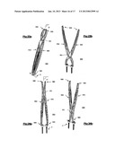 DEVICE AND METHOD FOR SPINAL SURGERY diagram and image