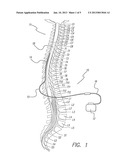 NEURAL STIMULATION LEAD FIXATION diagram and image