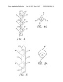 NEURAL STIMULATION LEAD FIXATION diagram and image