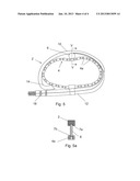 ANNULOPLASTY RING SYSTEM diagram and image