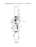 Transcutaneous Joint Unloading Device and Method diagram and image