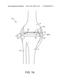 DYNAMIC KNEE BALANCER WITH PRESSURE SENSING diagram and image