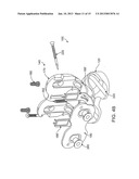 DYNAMIC KNEE BALANCER WITH PRESSURE SENSING diagram and image