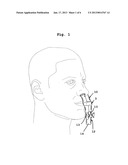 DEVICE IN CONNECTION WITH SLEEP APNOEAAANM Heinonen; JohnAACI MarstaAACO SEAAGP Heinonen; John Marsta SE diagram and image