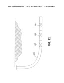 RETRIEVABLE STIMULATION FRAC (RSF) PLUGAANM Jani; WilliamAACI CalgaryAACO CAAAGP Jani; William Calgary CA diagram and image