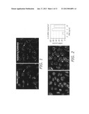 User interface method and system for management and control of automated     image processing in high content screening or high throughput screening diagram and image