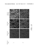 User interface method and system for management and control of automated     image processing in high content screening or high throughput screening diagram and image