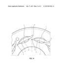 TURBOCHARGER VANE diagram and image