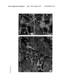 COMPOSITIONS COMPRISING CARDIAC STEM CELLS OVEREXPRESSING SPECIFIC     MICRORNAS AND METHODS OF THEIR USE IN REPAIRING DAMAGED MYOCARDIUM diagram and image