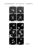 Antibody Specific for Apolipoprotein and Methods of Use Thereof diagram and image