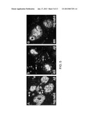 Antibody Specific for Apolipoprotein and Methods of Use Thereof diagram and image