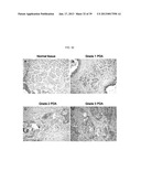 MAP KINASE KINASE KINASE KINASE 3 (MAP4K3) AS A BIOMARKER AND THERAPETIC     TARGET FOR AUTOIMMUNE DISEASE, CANCER, INFLAMMATION AND IL-17-ASSOCIATED     DISEASE diagram and image