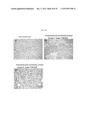 MAP KINASE KINASE KINASE KINASE 3 (MAP4K3) AS A BIOMARKER AND THERAPETIC     TARGET FOR AUTOIMMUNE DISEASE, CANCER, INFLAMMATION AND IL-17-ASSOCIATED     DISEASE diagram and image