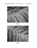 METHOD FOR ASSESSING THE CONDITION OF SKIN AND/OR SCALPAANM KOSAGA; MasaruAACI SingaporeAACO SGAAGP KOSAGA; Masaru Singapore SGAANM HE; ShanAACI BeijingAACO CNAAGP HE; Shan Beijing CNAANM GONG; TianGuiAACI GuangzhouAACO CNAAGP GONG; TianGui Guangzhou CN diagram and image