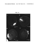 MODULATION OF OOCYTE MEIOTIC PROGRESSION AND OOCYTE ACTIVATION diagram and image