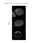 MODULATION OF OOCYTE MEIOTIC PROGRESSION AND OOCYTE ACTIVATION diagram and image