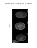 MODULATION OF OOCYTE MEIOTIC PROGRESSION AND OOCYTE ACTIVATION diagram and image