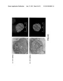 COMPOSITIONS AND METHODS FOR TREATING AIDS OR CANCER BY INHIBITING THE     SECRETION OF MICROPARTICLES diagram and image