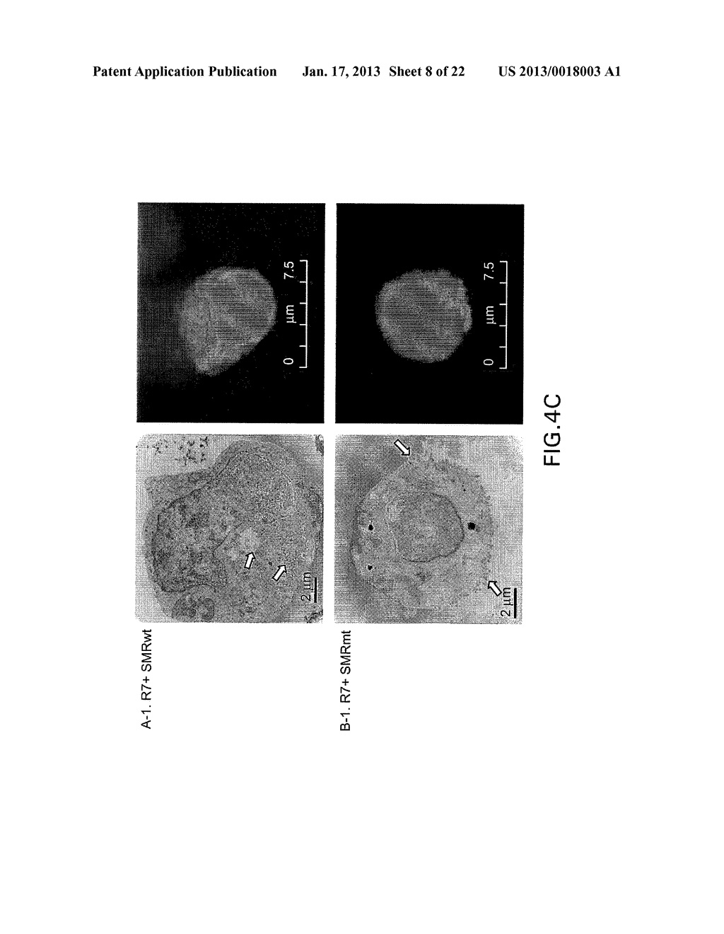 COMPOSITIONS AND METHODS FOR TREATING AIDS OR CANCER BY INHIBITING THE     SECRETION OF MICROPARTICLES - diagram, schematic, and image 09