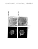 COMPOSITIONS AND METHODS FOR TREATING AIDS OR CANCER BY INHIBITING THE     SECRETION OF MICROPARTICLES diagram and image