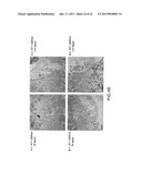 COMPOSITIONS AND METHODS FOR TREATING AIDS OR CANCER BY INHIBITING THE     SECRETION OF MICROPARTICLES diagram and image