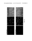 COMPOSITIONS AND METHODS FOR TREATING AIDS OR CANCER BY INHIBITING THE     SECRETION OF MICROPARTICLES diagram and image