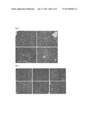 PHARMACEUTICAL COMPOSITION INCLUDING A TESTIS EXTRACT AS AN ACTIVE     INGREDIENT FOR TREATING AND PREVENTING ANEMIAAANM Choi; In-HoAACI Gyeongsan-siAACO KRAAGP Choi; In-Ho Gyeongsan-si KRAANM Lee; Dong-MokAACI DaeguAACO KRAAGP Lee; Dong-Mok Daegu KRAANM Lee; Eun-JuAACI DaeguAACO KRAAGP Lee; Eun-Ju Daegu KRAANM Lee; Ki-HoAACI SeoulAACO KRAAGP Lee; Ki-Ho Seoul KRAANM Cheon; Yong-PilAACI SeoulAACO KRAAGP Cheon; Yong-Pil Seoul KRAANM Chun; Tae-HoonAACI SeoulAACO KRAAGP Chun; Tae-Hoon Seoul KR diagram and image