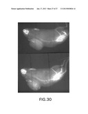 HALOGENATED PHENOLS FOR DIAGNOSTICS, ANTIOXIDANT PROTECTION AND DRUG     DELIVERY diagram and image